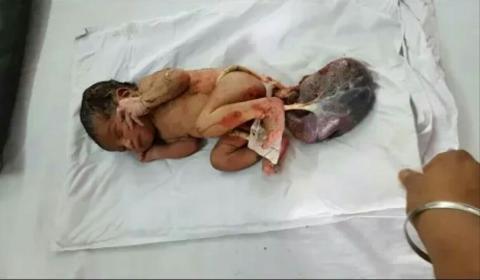 செய்த பிழையின் பரிசு